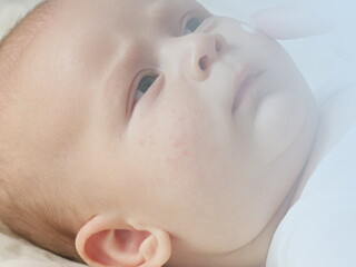 Алергии при бебетата – попитайте експерта 