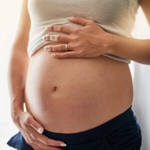 стрии при бременност